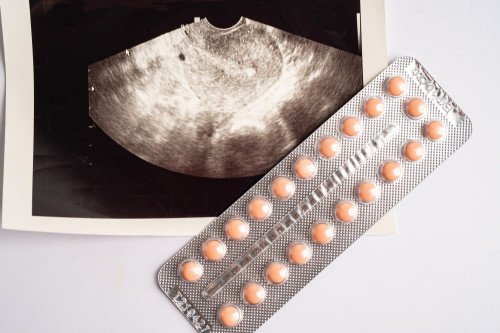 Wady tabletek antykoncepcyjnych - znane ryzyka